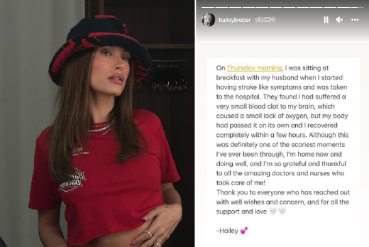 ヘイリー・ビーバー緊急入院「脳に血栓ができて脳卒中のような症状」 
