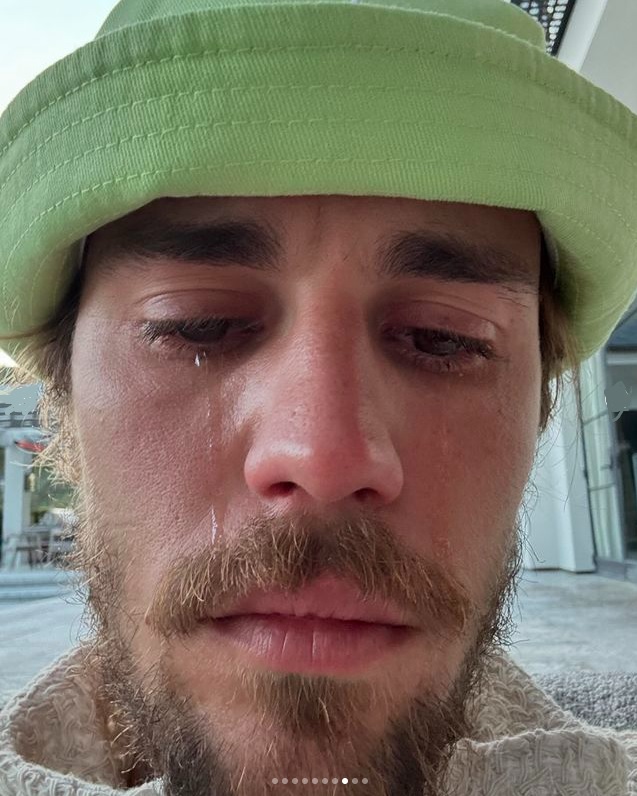 ジャスティン・ビーバー”泣き顔写真”インスタ投稿　妻ヘイリーのコメントがファンの間で物議